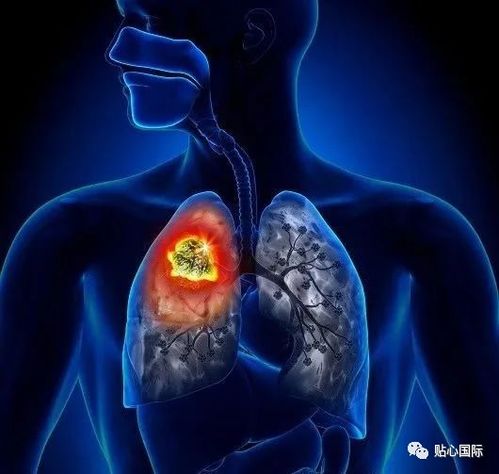 早晨头晕目眩会是肿瘤吗 早晨头晕目眩会是肿瘤吗