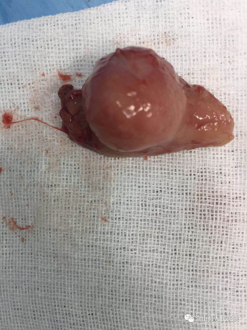 �᳦�����ܺȵ��׷���