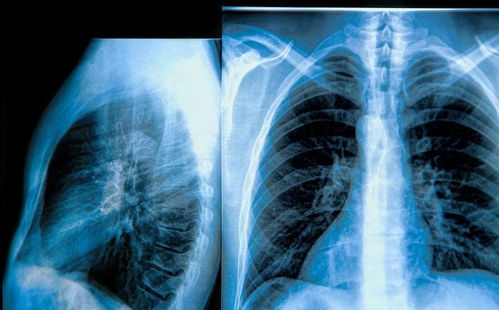 ���������Һ�����취