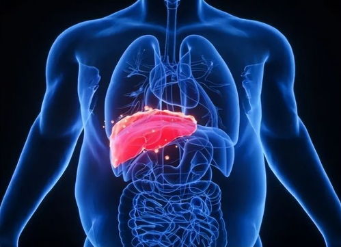 喝铁树叶肿瘤由硬变软了 喝铁树叶肿瘤由硬变软了