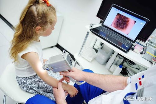 ���������ܾ�ѵ��(���������Բξ���)