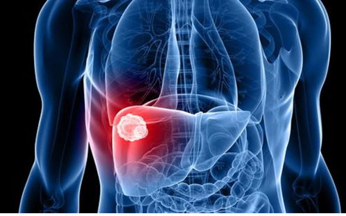 女性无月经还会有肿瘤 女性无月经还会有肿瘤