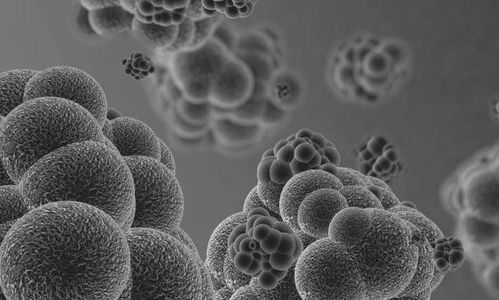 小淋巴细胞肿瘤能切除吗 小淋巴细胞肿瘤能切除吗