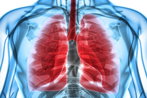 恶性骨肿瘤骨折诊断标准 恶性骨肿瘤骨折诊断标准