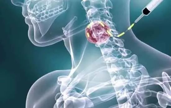 Сϸ����������_Сϸ������������ʲô��˼