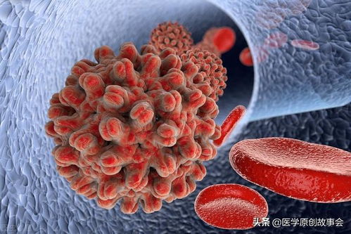 良性卵巢肿瘤手术治疗 良性卵巢肿瘤手术治疗