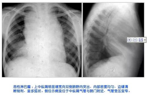 南京肿瘤中医专家 南京肿瘤中医专家介绍 南京肿瘤中医专家 南京肿瘤中医专家介绍