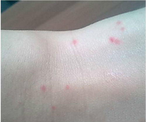 颌下腺肿瘤打疼吗 颌下腺肿瘤打疼吗