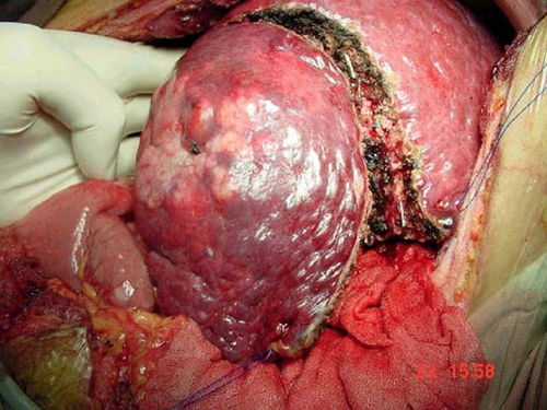 ����ֱ�������Ƕ��Ե�