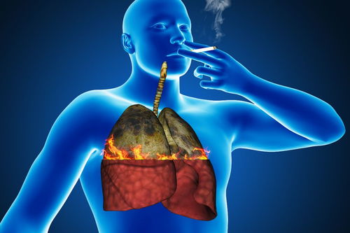 小肠壁上长肿瘤怎么办 小肠壁上长肿瘤怎么办