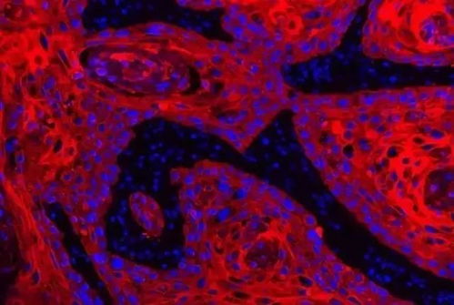 肿瘤联盟网 肿瘤专科联盟 肿瘤联盟网 肿瘤专科联盟