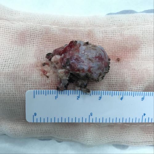 ������ʹ�����ܻ���