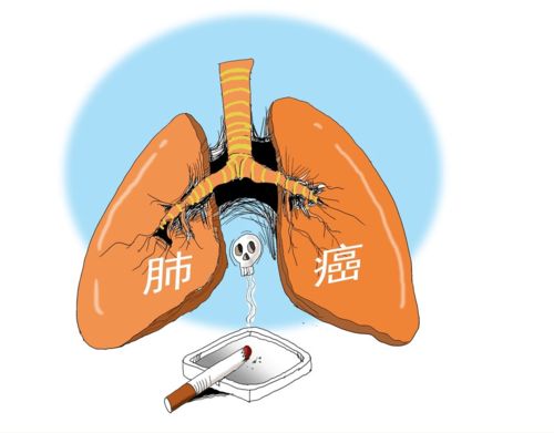 什么肿瘤能转移到肝脏 什么肿瘤能转移到肝脏