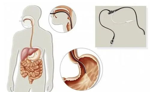 良性肿瘤可以伴随炎症吗 良性肿瘤可以伴随炎症吗