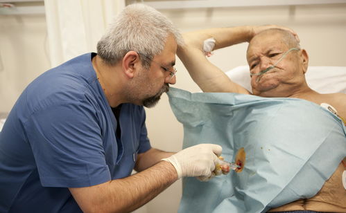 手背腱鞘囊肿是肿瘤吗 手背腱鞘囊肿是肿瘤吗