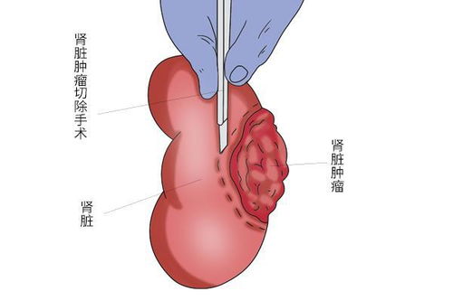 ������ѪҺָ��������