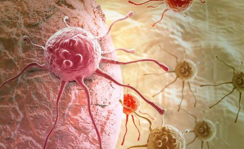 下肢肿瘤吃什么好得快 下肢肿瘤吃什么好得快