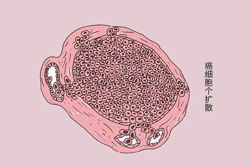 生活中7个非常实用小偏方来咯 生活中7个非常实用小偏方来咯