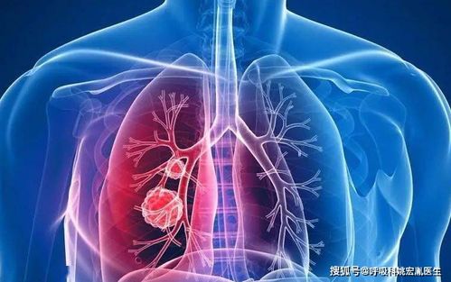 顶管机设备(顶管) 顶管机设备(顶管)