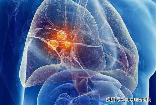 重庆肿瘤医院地下车库 重庆肿瘤医院地下车库