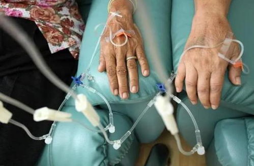 腹部肿瘤ct片子怎么看 腹部肿瘤ct片子怎么看