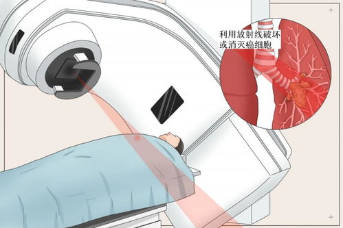 胃肿瘤晚期吃什么食物 胃肿瘤晚期吃什么食物