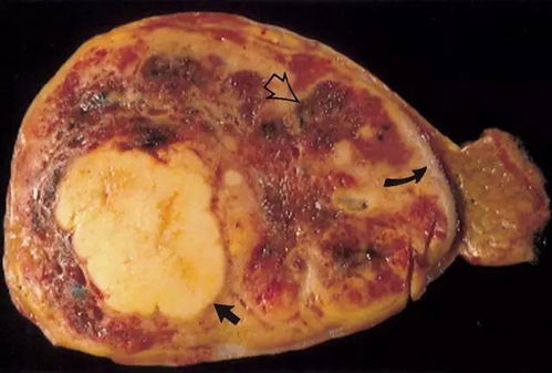 ��ķɭ ��ķɭ�۸�