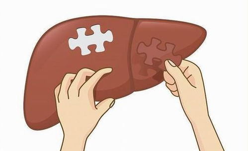 乳腺结节4级肿瘤严重吗 乳腺结节4级肿瘤严重吗