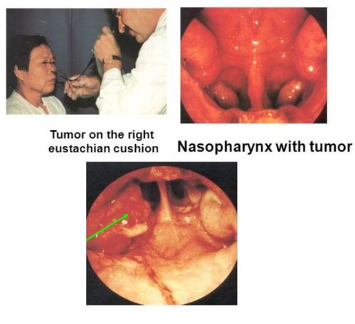 ����С����֮����Ը��