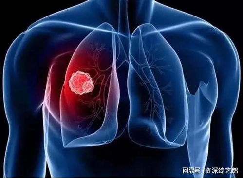 襄肿与肿瘤有什么区别 襄肿与肿瘤有什么区别