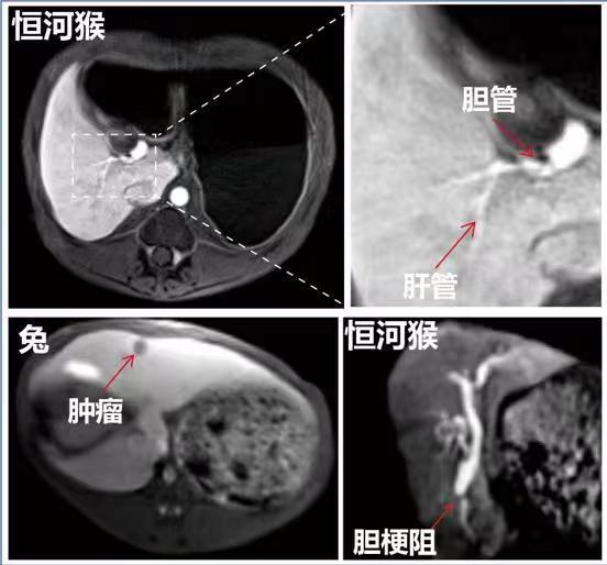 左肋骨头疼是肿瘤复发吗 左肋骨头疼是肿瘤复发吗