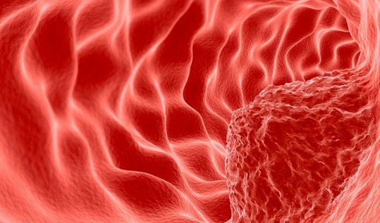 盆腔有包块查肿瘤标志物 盆腔有包块查肿瘤标志物