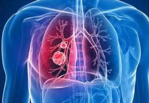 天津肿瘤医院康复科专家 天津肿瘤医院康复科专家