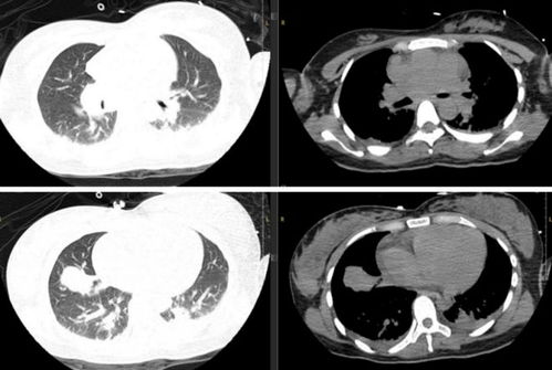 徐帆最近演过的电视剧 徐帆最近演过的电视剧