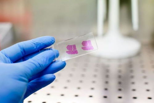 韩国被私生杀死的明星 韩国被私生杀死的明星