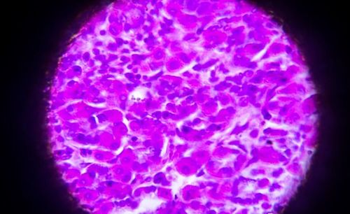 70�������Ҳ��������