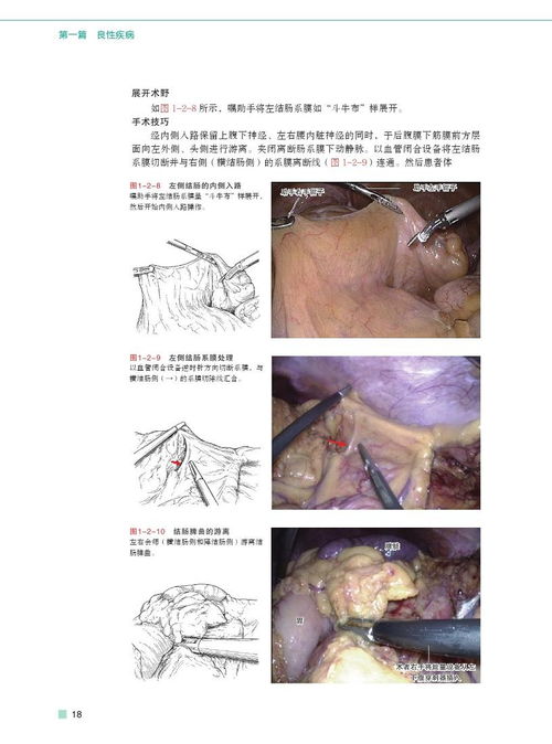 蔡卓妍为什么嫁郑中基 蔡卓妍为什么嫁郑中基