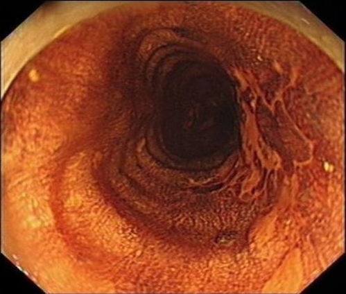 浙江中医治肿瘤名医名单 浙江中医治肿瘤名医名单