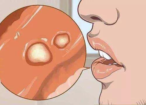 肺癌肿瘤切除后疼吗疼吗 肺癌肿瘤切除后疼吗疼吗