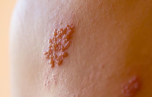 ��������ǰ�ܳ�������