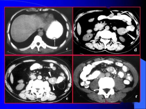 ��ǻ�ܲ����ʲô����