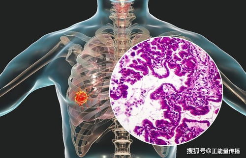 ���ӹ���������30�����������