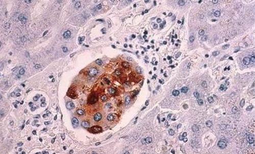 �ΰ�������������ô��