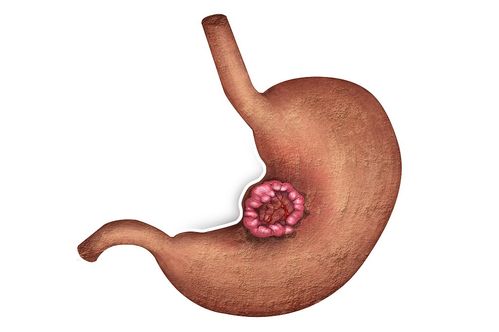 �������������ʲô��