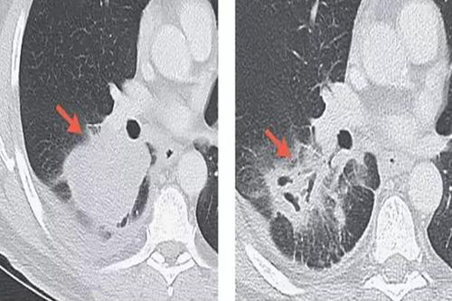 �������������������ĸ��