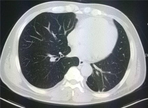 杨幂时装周 杨幂时装周穿的裙子 杨幂时装周 杨幂时装周穿的裙子