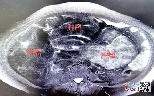 150ҽԺ�����ƽ�ž�150ҽԺ������